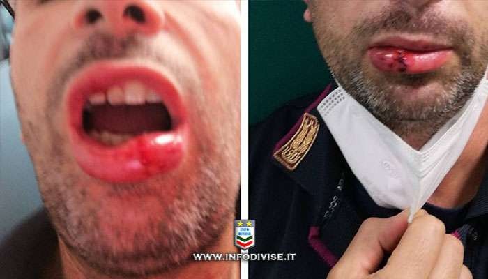 Polizia di stato aggressione milano